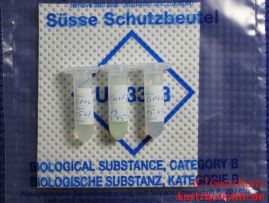 Testosteron Speicheltest von verisana - beschriftete Speichelröhrchen